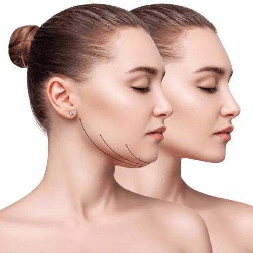 Benefits of Acne Treatment