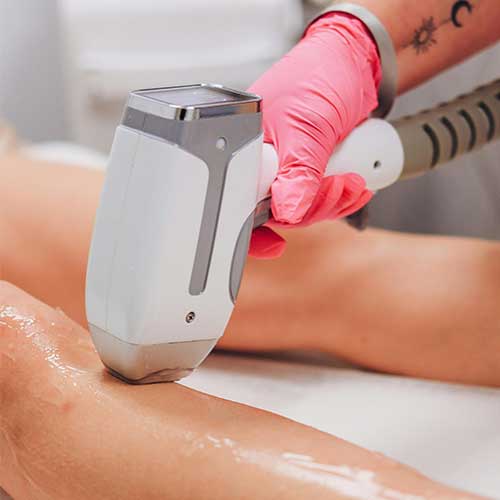 Laser Treatment