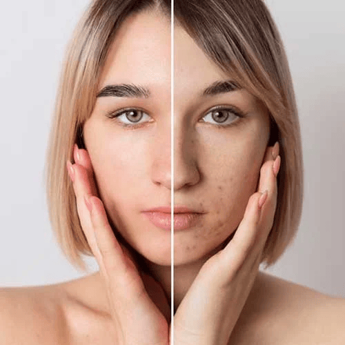 Before and After Skin Tightening